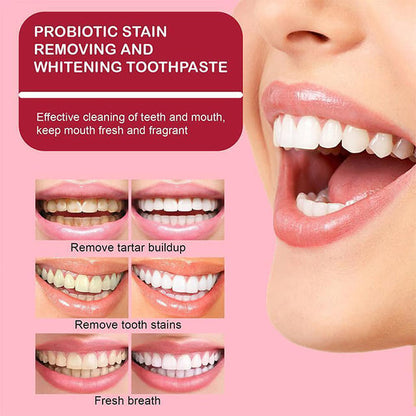 SP-6 Probiotic Whitening Toothpaste✨�