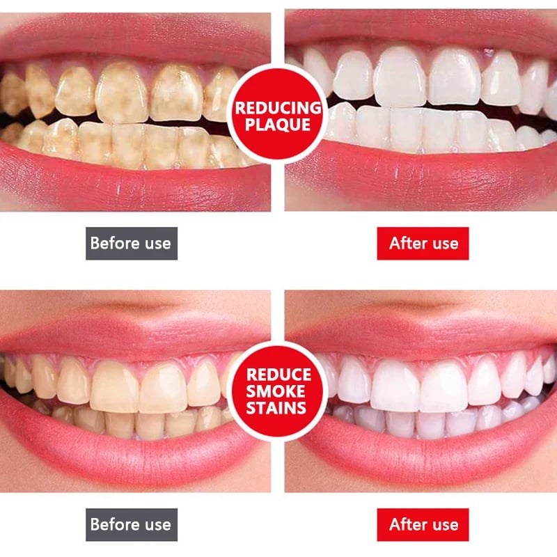 SP-6 Probiotic Whitening Toothpaste✨�